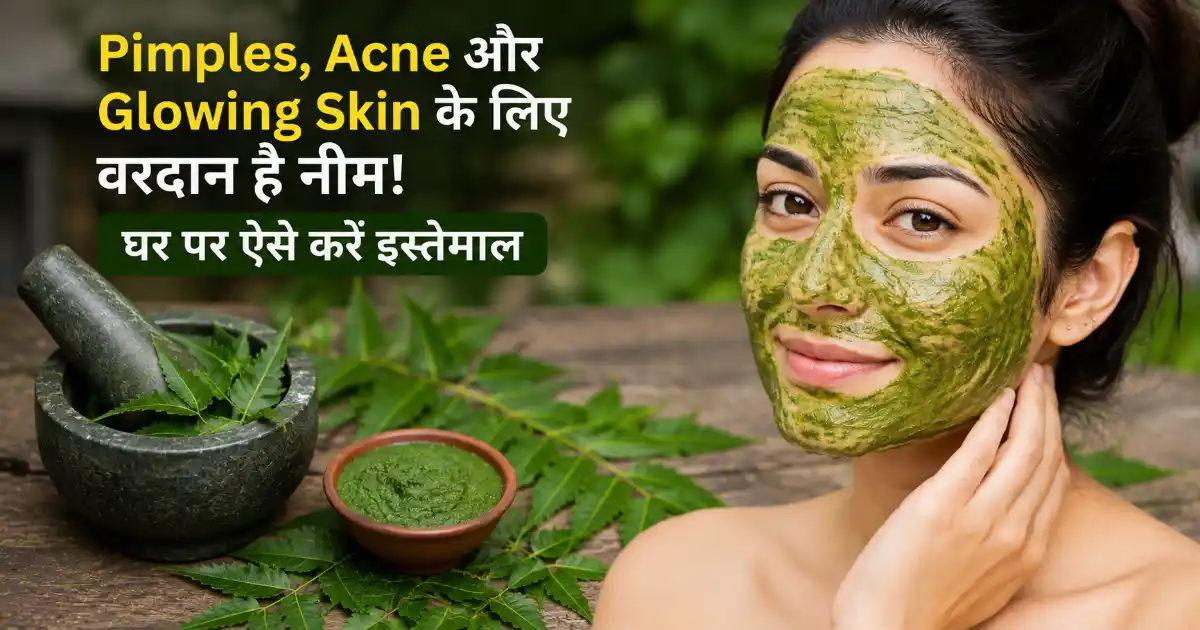Face Care : Pimples, Acne और Glowing Skin के लिए वरदान है नीम! घर पर ऐसे करें इस्तेमाल….